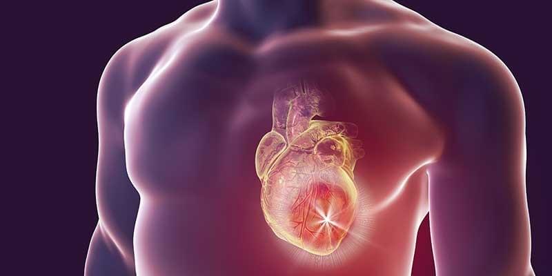 Myocarditis Treatment, Causes and Symptoms. Myocarditis Treatment, Causes and Symptoms.