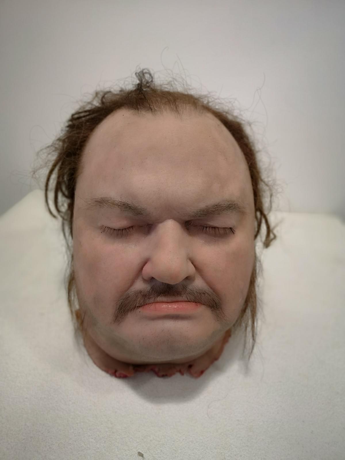 Silicone prosthetic head from HOD Bobby McGlynn hair punching by Deborah Reidy in Odyssey Studios Limerick Silicone prosthetic head from HOD Bobby McGlynn hair punching by Deborah Reidy in Odyssey Studios Limerick