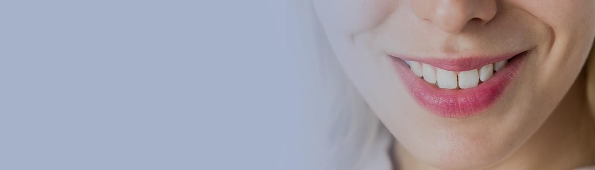 cosmetic dental Moonee Ponds cosmetic dental Moonee Ponds