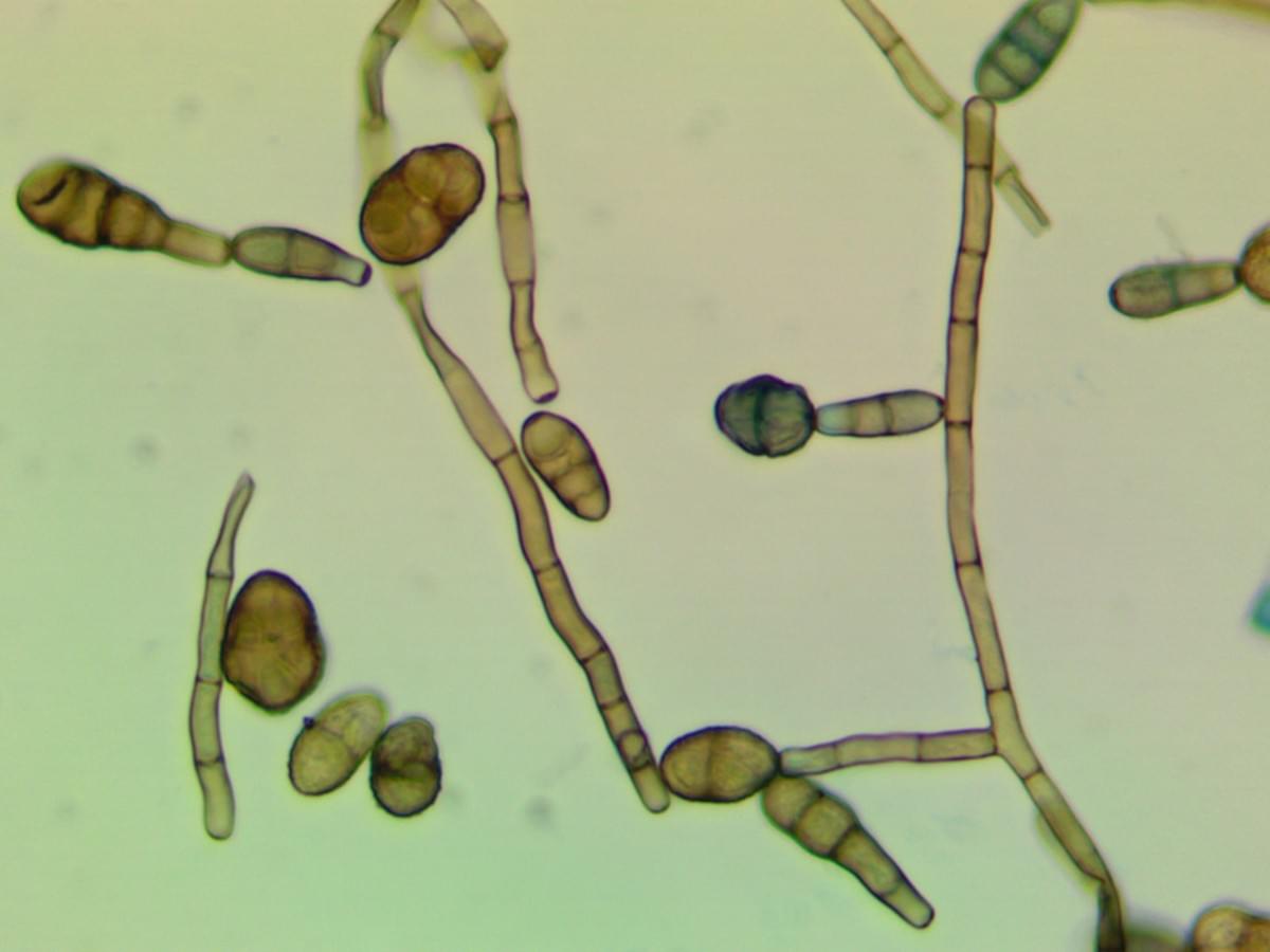 Alternaria alternata fungal spores. Alternaria is a frequent contaminant in water damaged homes. Image courtesy of Biological Health Services. Alternaria alternata fungal spores. Alternaria is a frequent contaminant in water damaged homes. Image courtesy of Biological Health Services.