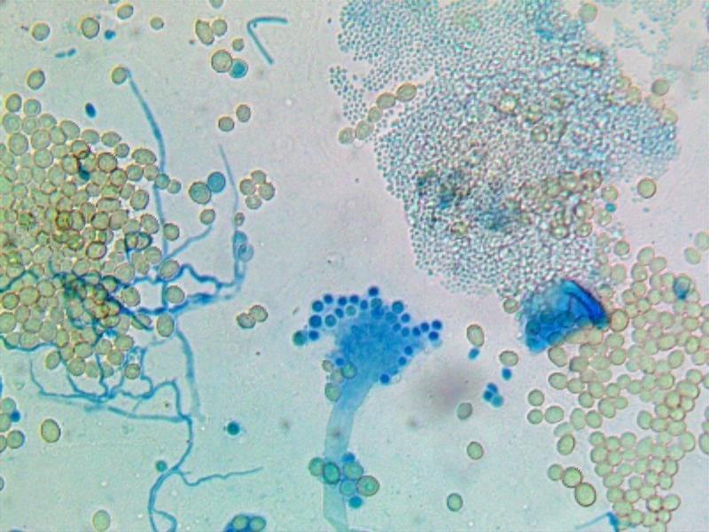 Toxic mould spore and plumes from shower and drain and sink use can cross contaminate nearby areas causing unexpected illness Toxic mould spore and plumes from shower and drain and sink use can cross contaminate nearby areas causing unexpected illness