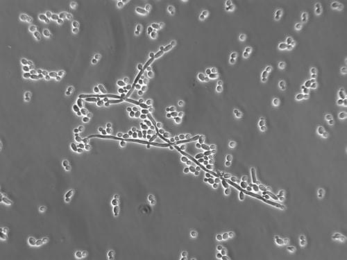 how to heal candida naturally with naturopathy and ayurveda how to heal candida naturally with naturopathy and ayurveda