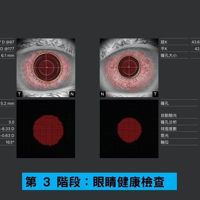 第 3 階段:眼睛健康檢查 篩查會告訴我們更多關於您的視力的信息,並使我們能夠確定哪種蔡司精密鏡片最適合您。 我們的篩查包括對您的視力進行徹底的初步檢查。 第 3 階段:眼睛健康檢查 篩查會告訴我們更多關於您的視力的信息,並使我們能夠確定哪種蔡司精密鏡片最適合您。 我們的篩查包括對您的視力進行徹底的初步檢查。