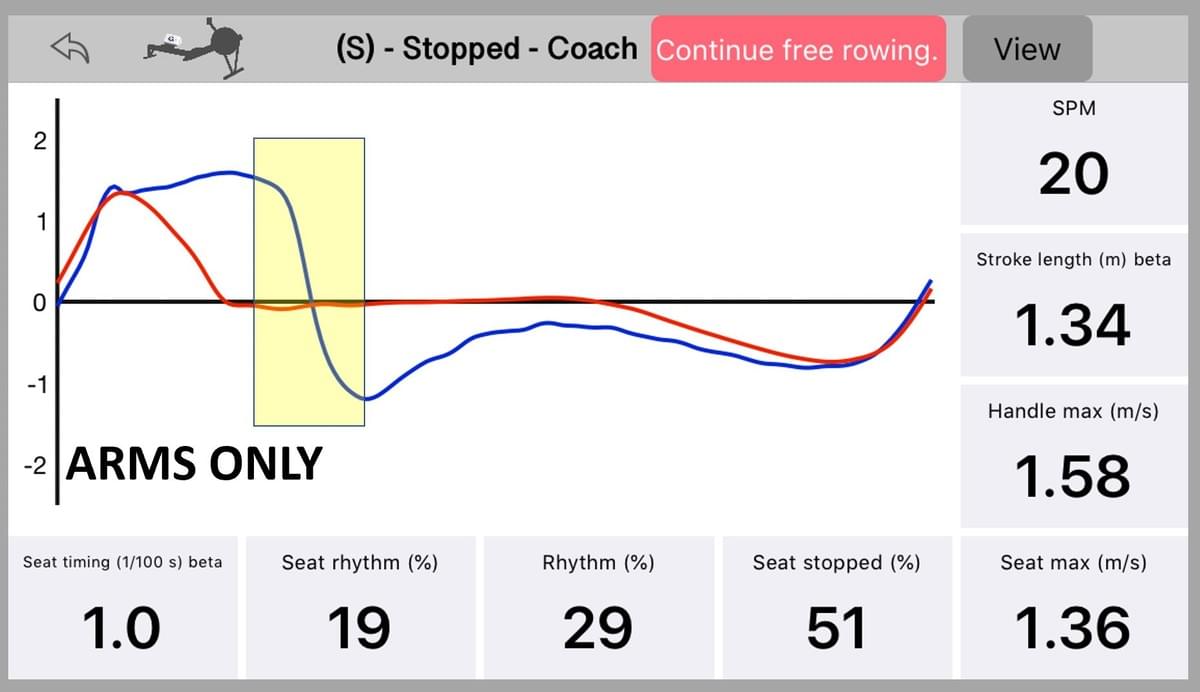 Seat and handle speed measured with Quiske, Arms portion colored yellow. Seat and handle speed measured with Quiske, Arms portion colored yellow.
