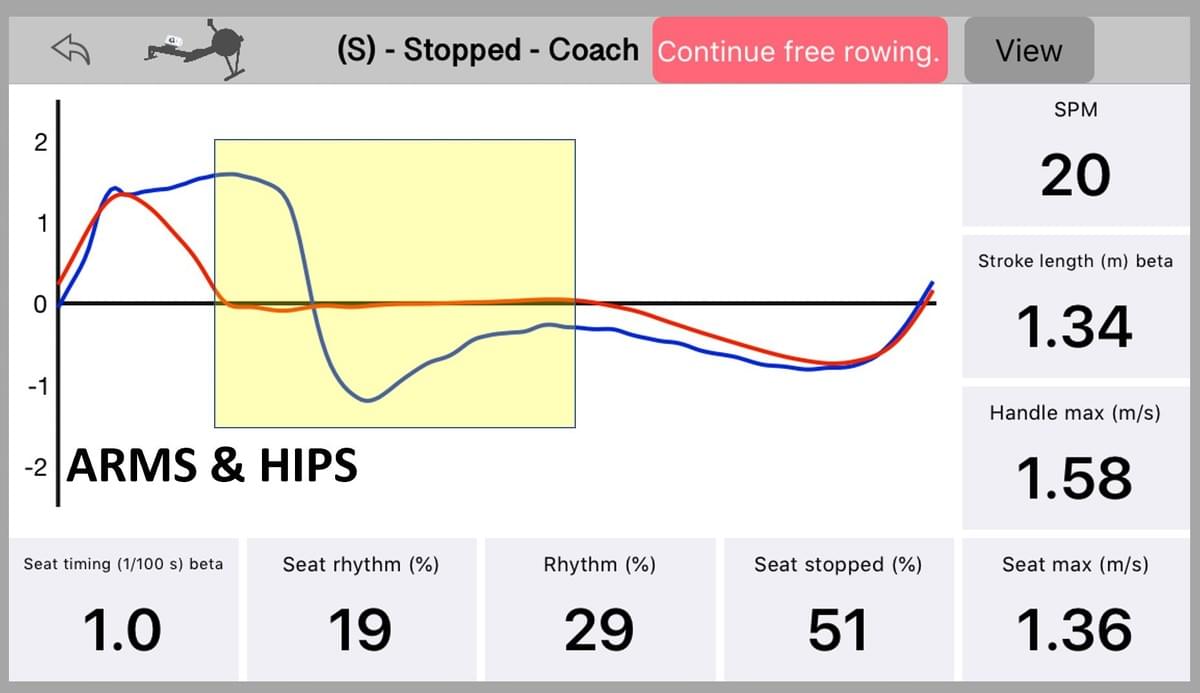 Seat and handle speed as measured with Quiske: Arms&Hips portion colored yellow. Seat and handle speed as measured with Quiske: Arms&Hips portion colored yellow.
