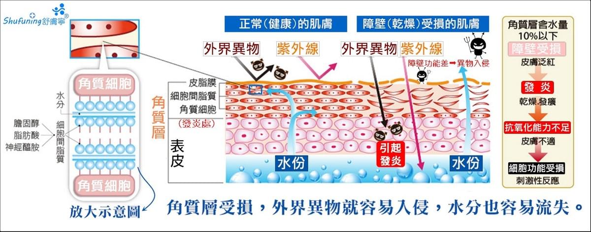 舒膚寧角質療程-(異位性皮膚炎,濕疹,牛皮癬,問題皮膚)濕敷療法 舒膚寧角質療程-(異位性皮膚炎,濕疹,牛皮癬,問題皮膚)濕敷療法