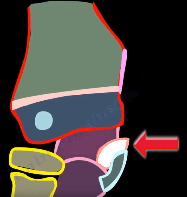 Pediatric Elbow Dislocation Orthopedic Surgery Elbow