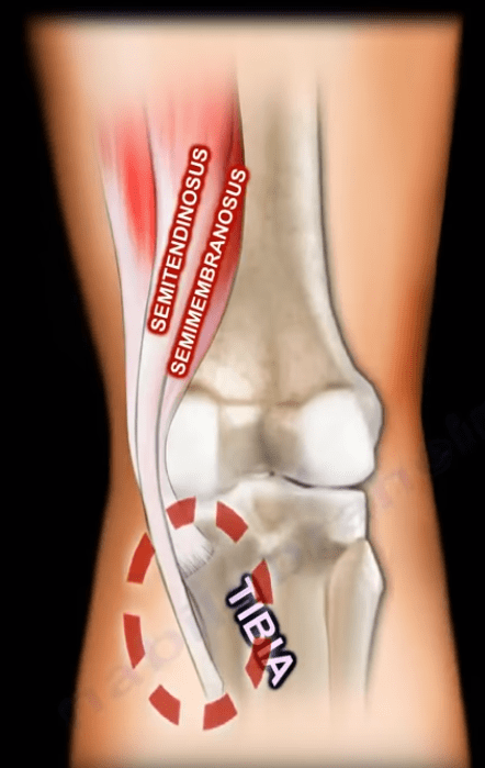 Anatomy of the Popliteal Fossa - Orthopedic Surgery Popliteal Fossa