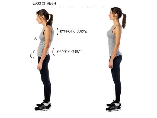 Fixing Posture problems and back pain in Wexford, Ireland. Fixing Posture problems and back pain in Wexford, Ireland.