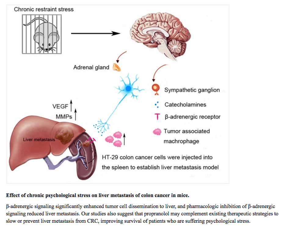 stress et cancer du colon stress et cancer du colon