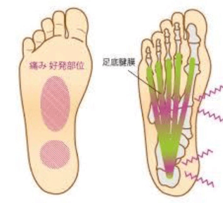 足の裏 足の裏