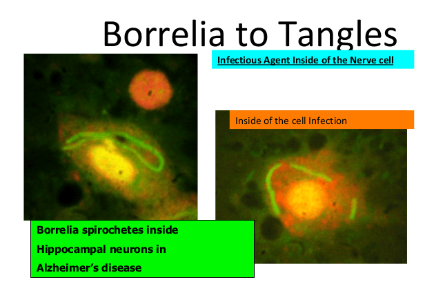 borrelia lyme co infection dietrich klinghardt borrelia lyme co infection dietrich klinghardt