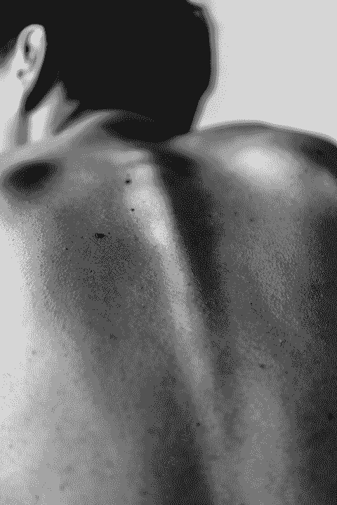 broken image