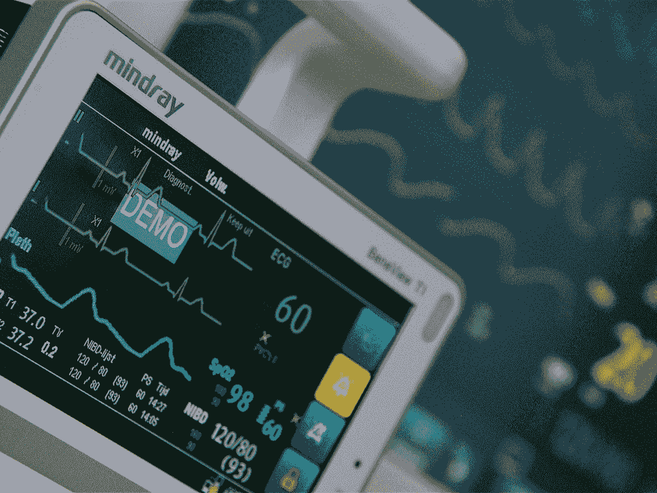 Portable ECG Monitor