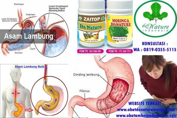 Obat Sakit Perut Melilit Pada Orang Dewasa Di Apotik Salep Kutil Kelamin Obat Kutil Kelamin