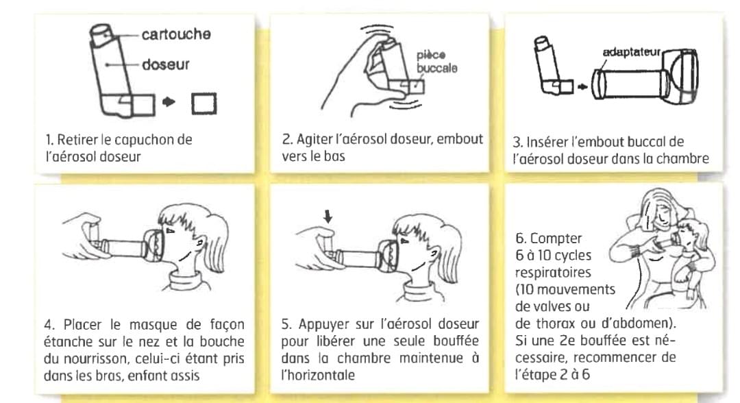 Asthme Du Nourrisson Article 2 3 Place Des Parents Da