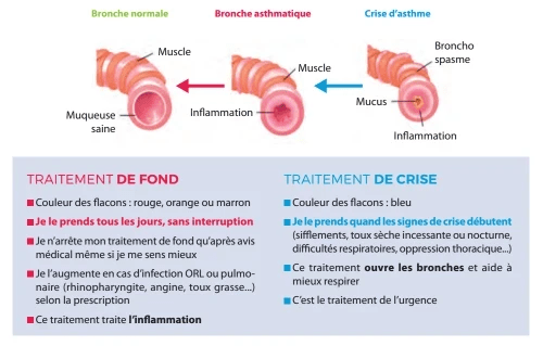 Asthme Du Nourrisson Article 2 3 Place Des Parents Da