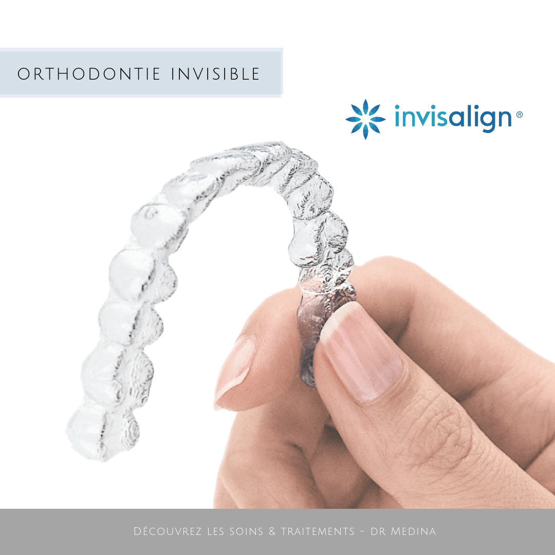 Invisalign - orthodontie à Paris 8 | Dr Médina