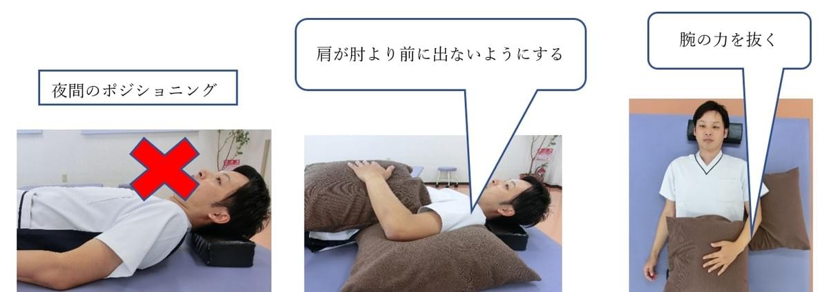 成田整形のリハビリ 成田整形外科 千葉県成田市