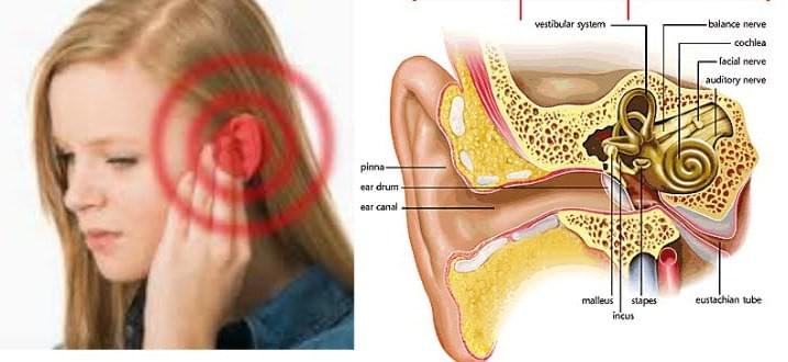 Telinga Berdengung Bisa Sembuh Dengan Qnc Jelly Gamat