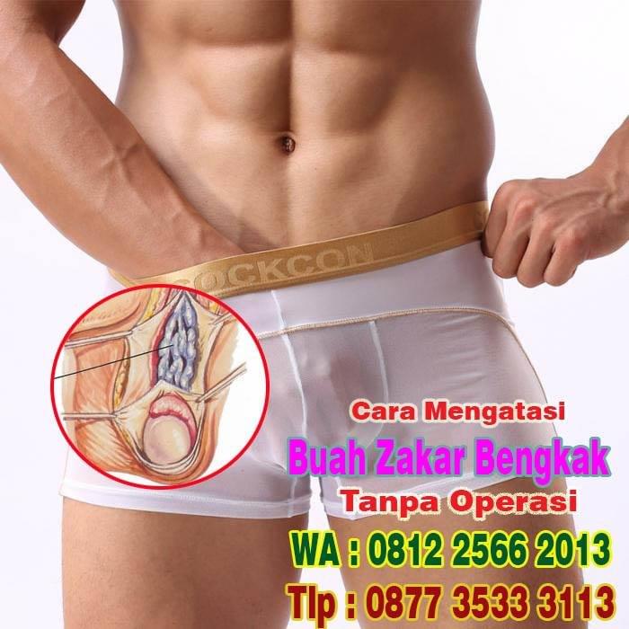 Obat Buah Zakar Sakit Testis Bengkak Besar Sebelah Kiri Dan Kanan Testes Kendur Mengendur Obat Varikokel Obat Testis Nyeri Bengkak Pada Buah Zakar Obat Hernia Herbal Aman Tanpa Efek Samping Gamat