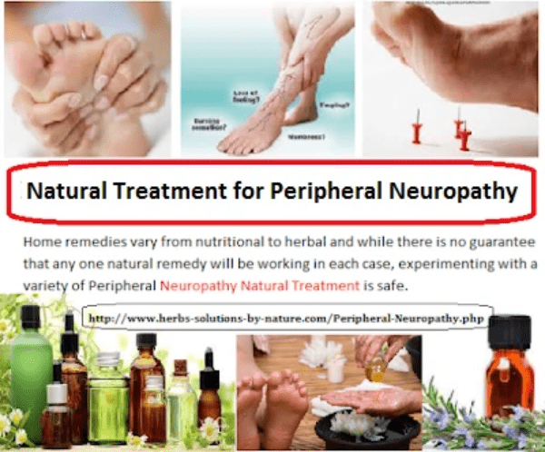 Natural Remedies For Peripheral Neuropathy Relief From Painful Symptoms Peripheral Neuropath Read about treatments for peripheral neuropathy, which may include treating any underlying cause as well as any symptoms you're experiencing. peripheral neuropathy relief