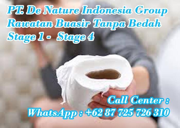 Jenis Jenis Ubat Kecutkan Buasir Selepas Bersalin Berkesan Punca Buasir Merawat Buasir Kempiskan Buasir Herba Buasir Ubat Buasir