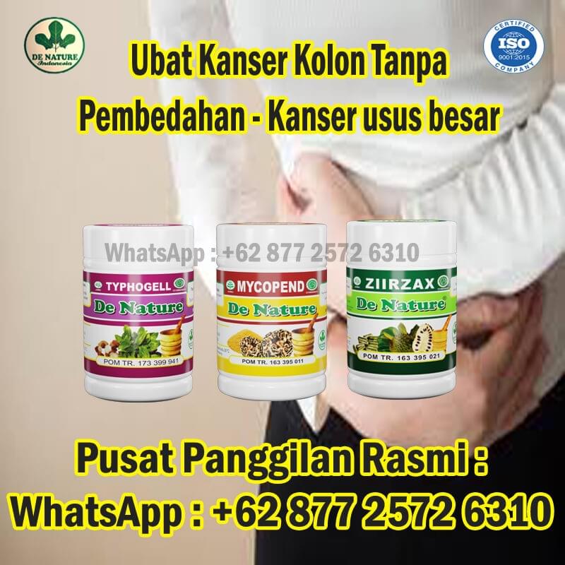 Sebaris Gejala Kanser Kolon Peringkat Awal Hingga Lanju