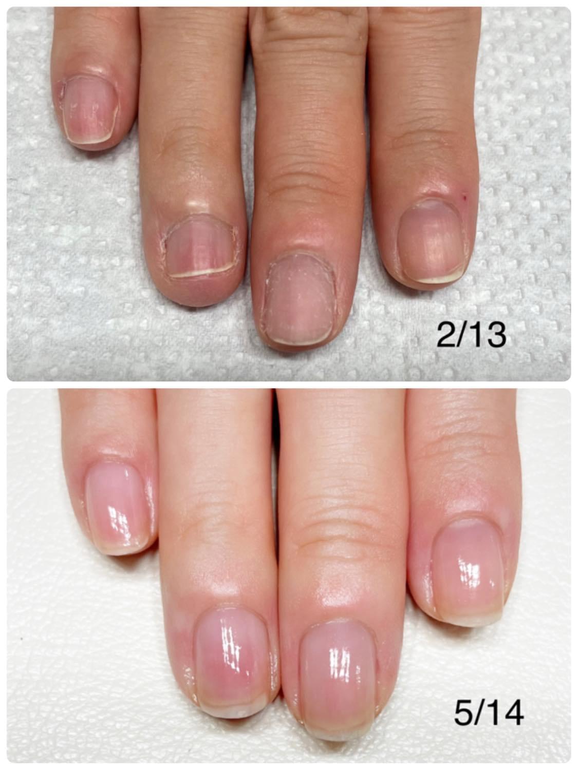 表参道 ネイルサロン I 自爪育成ネイルケア専門店 ジャクリーンバーチェル 表参道 ネイルサロン I 自爪育成ネイルケア専門店 ジャクリーンバーチェル