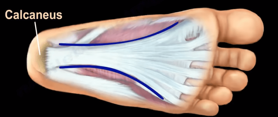 plantar fascia thongs