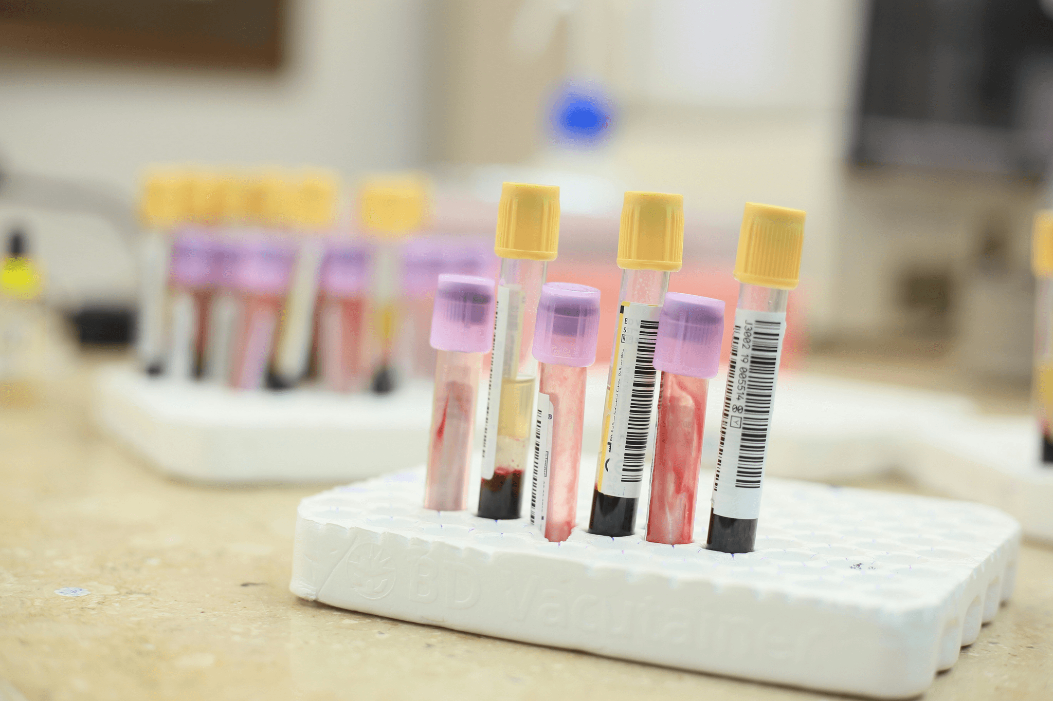 Chemical Testing Analysis for Qualitative Analyses in Industry