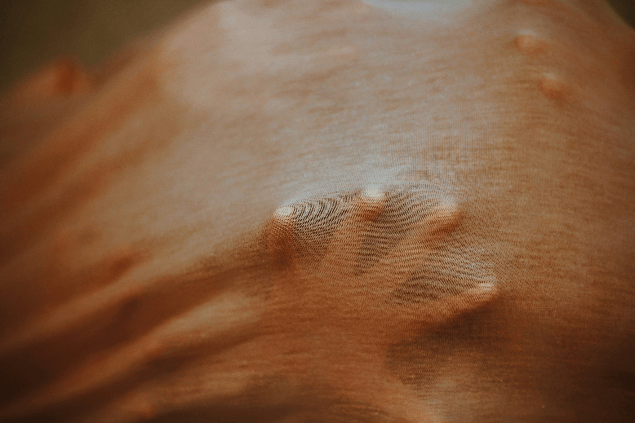 長過水痘就沒事了嗎？帶狀皰疹（皮蛇）懶人包｜淺顯易懂的行醫筆記｜療寮診所．板橋江子翠｜家醫科診所．健保一般科