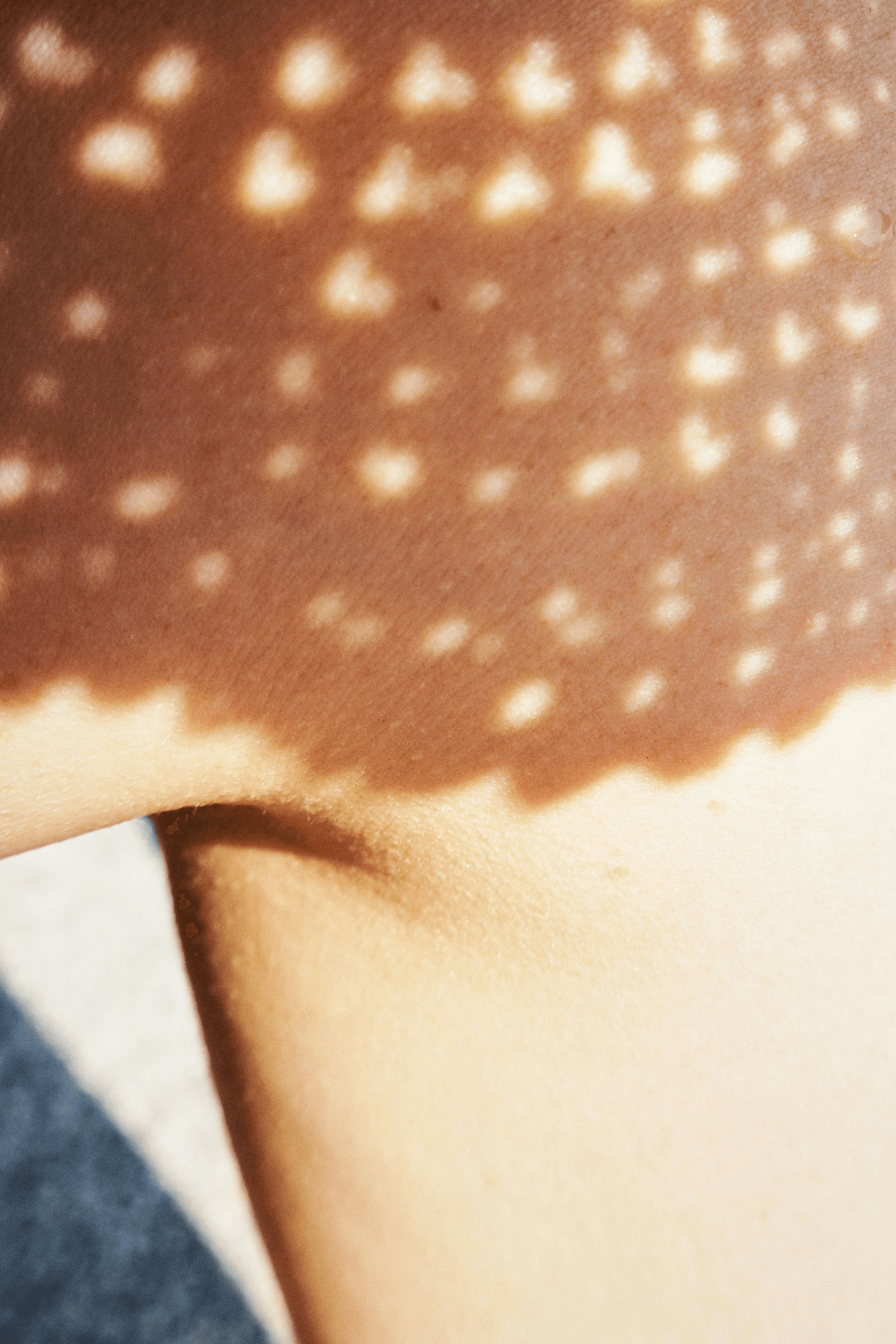 皮膚癢｜如何識別和治療？濕疹、蕁麻疹、乾癬、糖尿病都有可能？一文帶你了解皮膚癢的識別方法、潛在風險及治療｜淺顯易懂的行醫筆記｜療寮診所．板橋江子翠｜家醫科診所．健保一般科