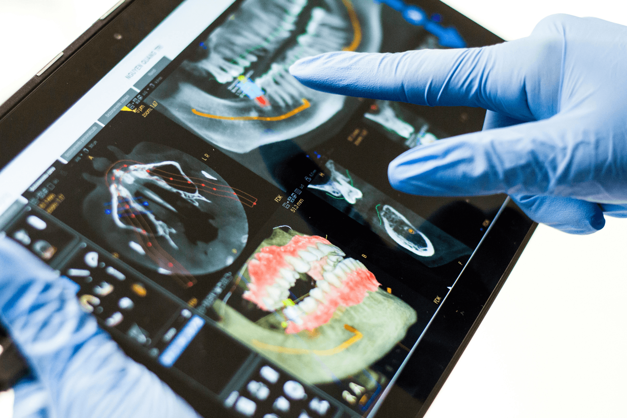 Rugged PC in Mobile Healthcare