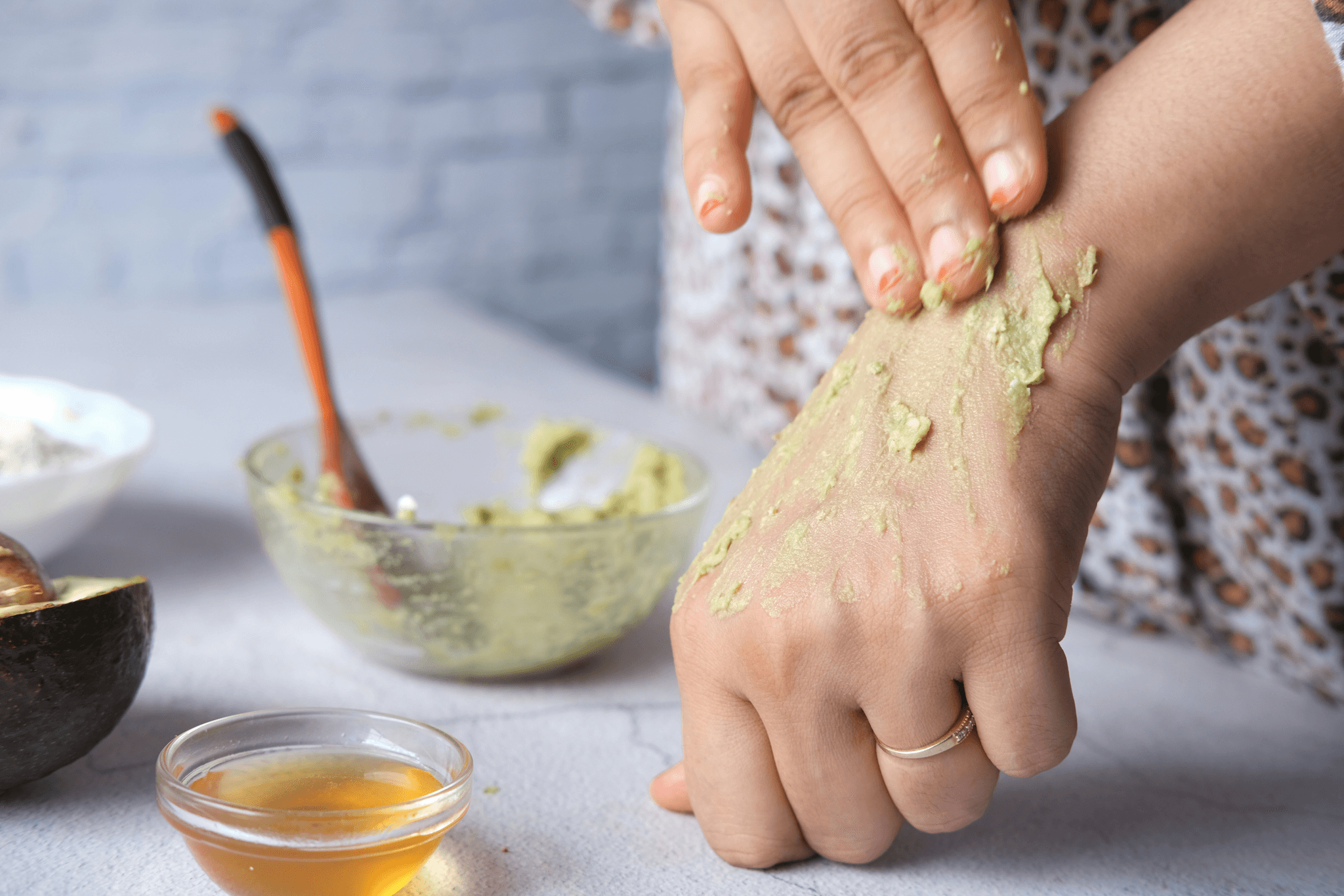 皮膚癢｜如何識別和治療？濕疹、蕁麻疹、乾癬、糖尿病都有可能？一文帶你了解皮膚癢的識別方法、潛在風險及治療｜淺顯易懂的行醫筆記｜療寮診所．板橋江子翠｜家醫科診所．健保一般科