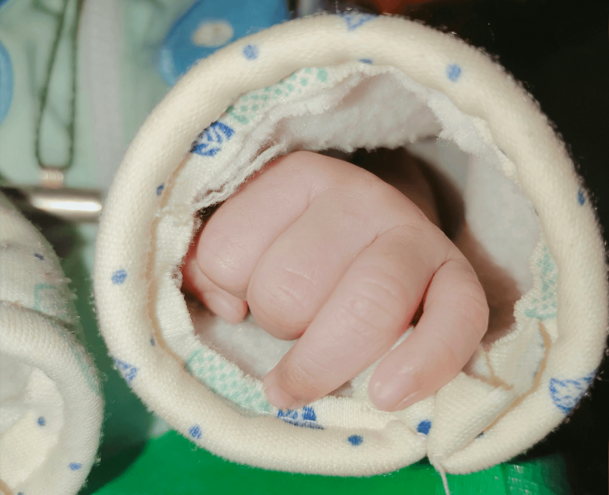 Diaper Inspection for Quality Control