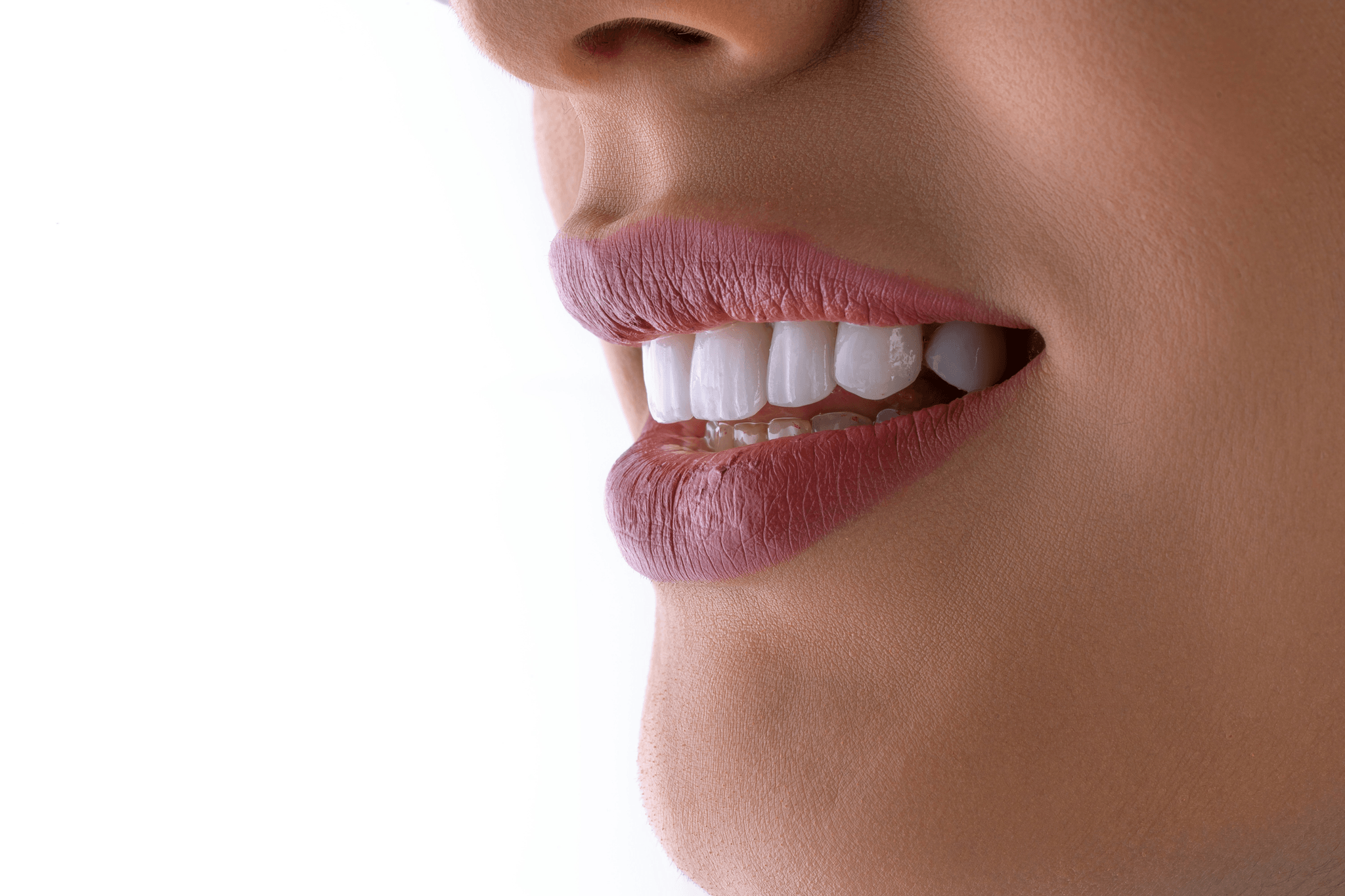 Professional Teeth Whitening